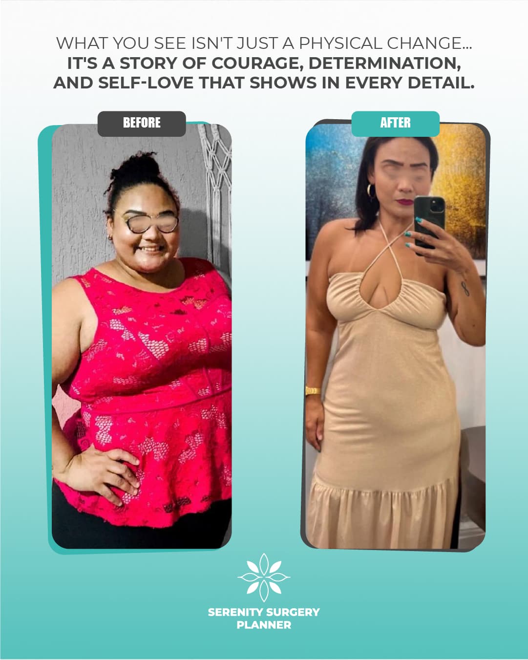 before and after