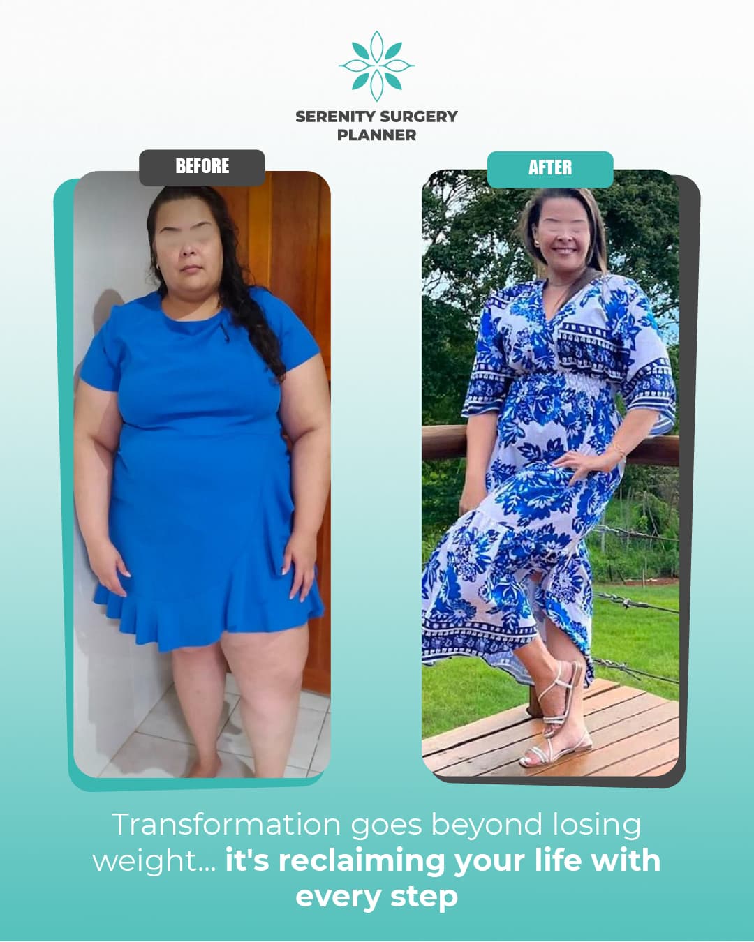 before and after