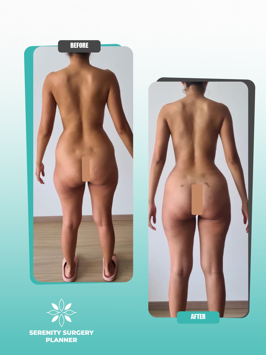 before and after