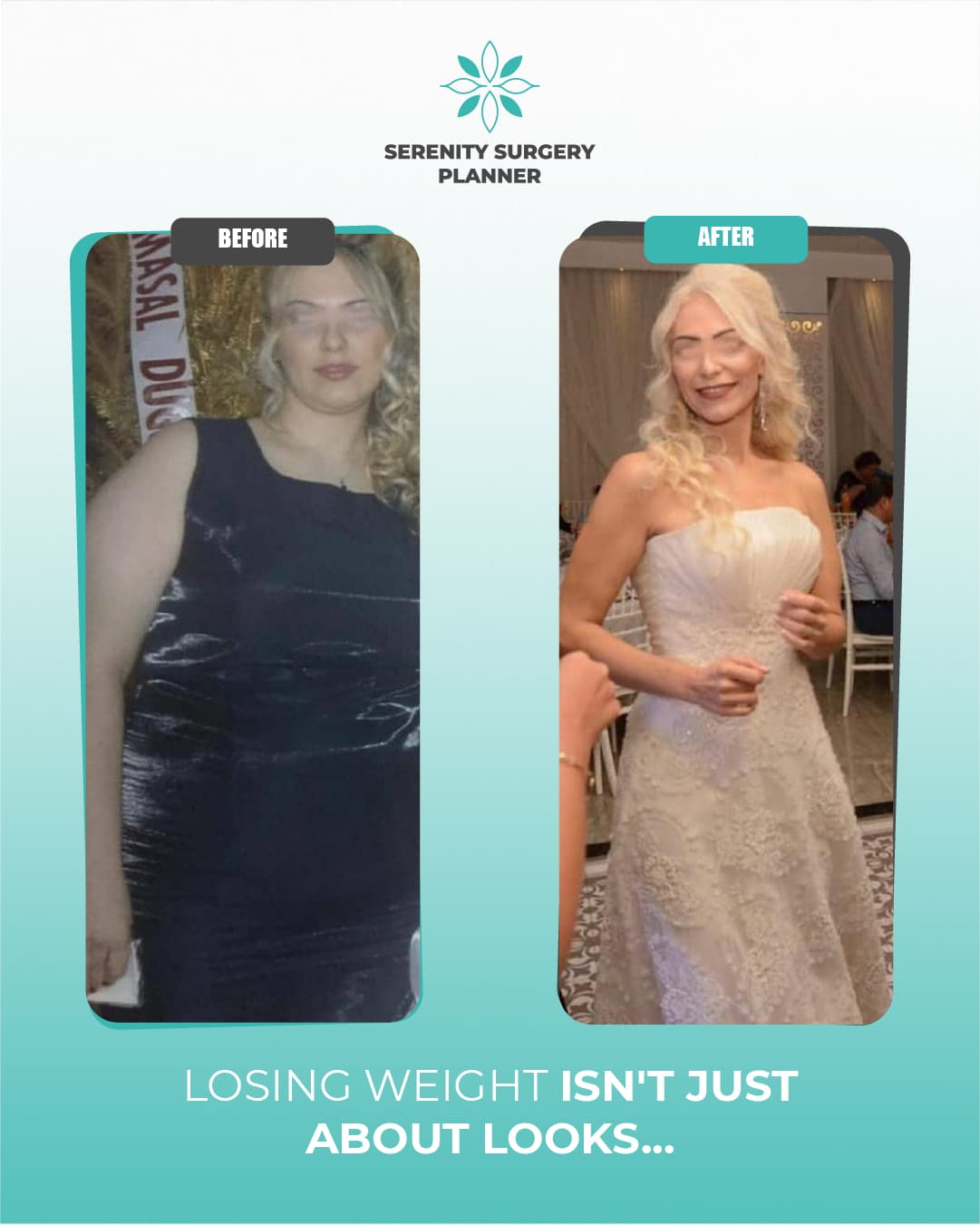 before and after