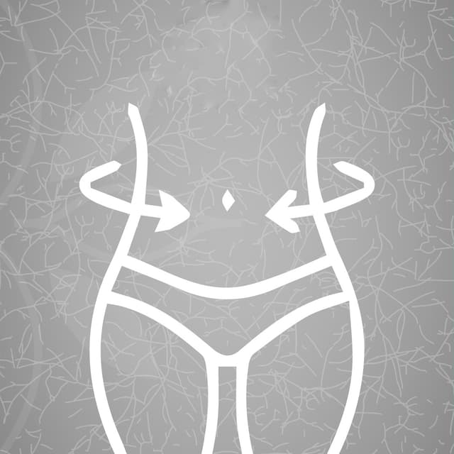 Gastric Sleeve Illustration